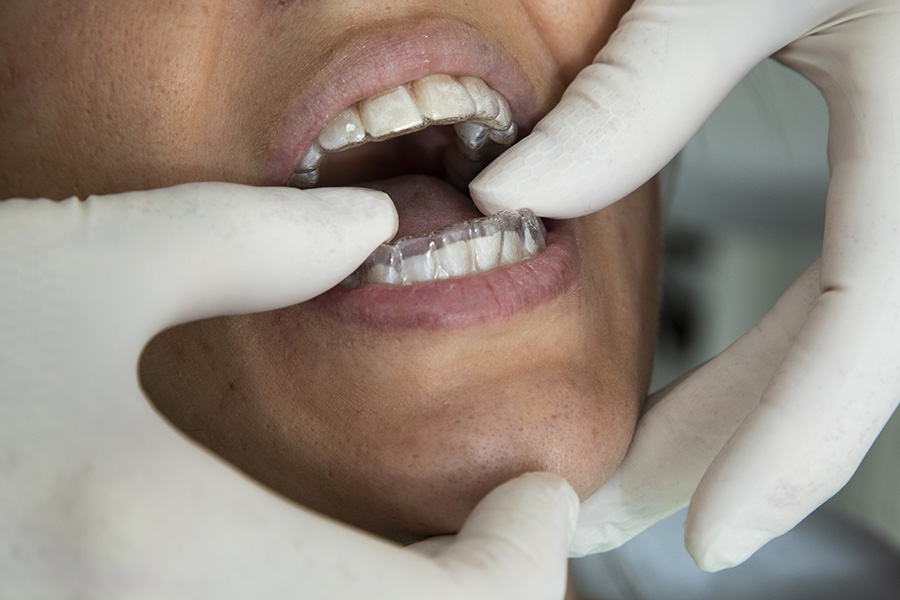 ortodonzia e gnatolgoia a Piombino