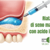 rialzo-seno-mascellare-acido-ialuronico-piombino