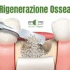 Illustrazione del processo di rigenerazione ossea dentale tramite inserimento di materiale biocompatibile per impianti.